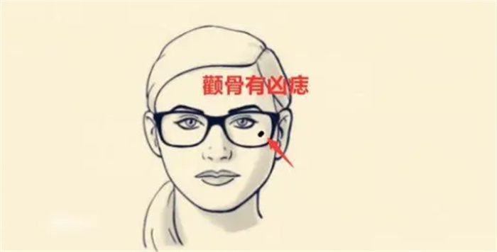 ĘϾŴ鲻װl(f)ù
