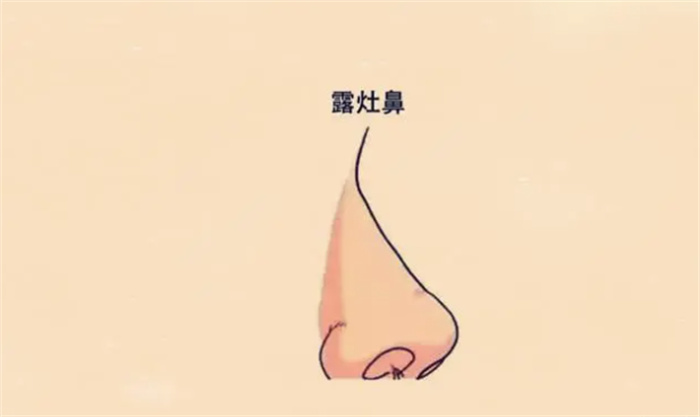 ķN©ؔ(ci)ʧI(y)yɣһD