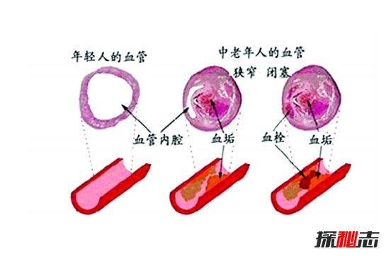 地龍的藥用價(jià)值極高