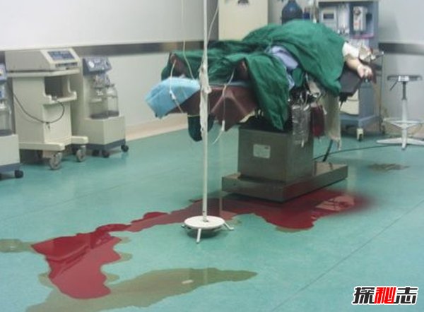 生孩子為什么孕婦會(huì)死?孕產(chǎn)婦死亡率最高的十個(gè)國家