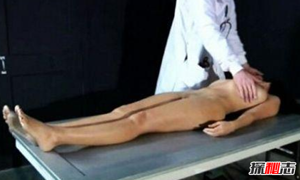 什么是注射死刑?注射死刑用的什么藥(常規(guī)的三種藥品)