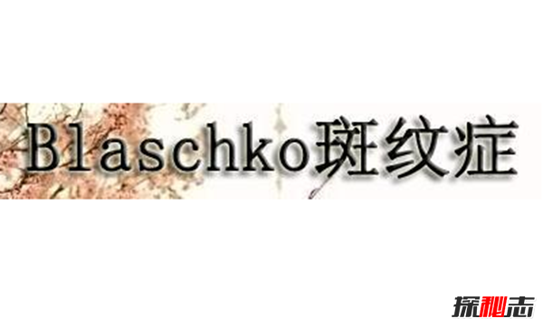 Blaschko߼yYʲô?ȫLMlyĺҊֲ