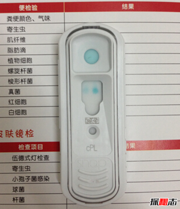 ʲôǎdϾCϰY?^Ƥ|(zh)µļ