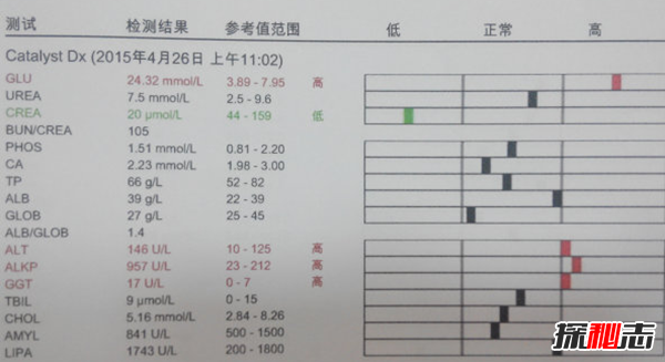 ʲôǎdϾCϰY?^Ƥ|(zh)µļ
