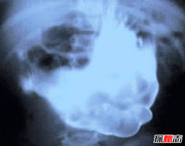 x光片發(fā)現(xiàn)十大最恐怖的東西,你絕對想不到居然有它