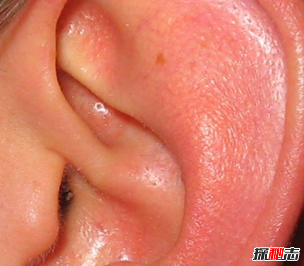 吃魷魚(yú)懷了寶寶?發(fā)生在自己身邊的十大怪事